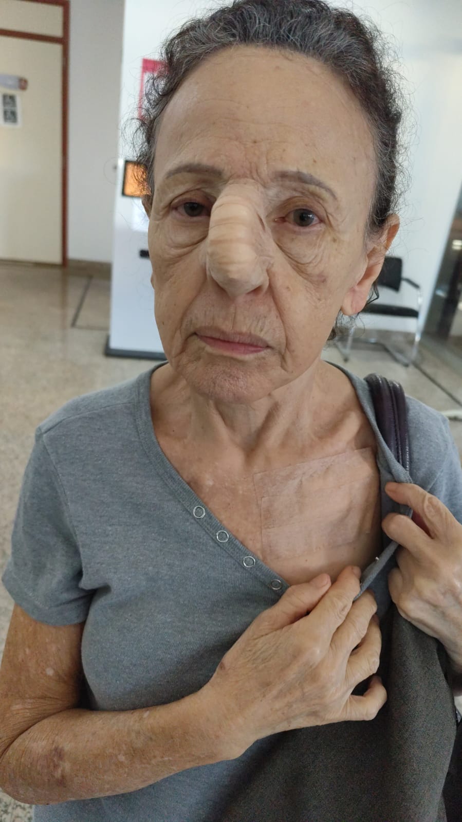 Ação solidária em prol do tratamento da mamãe