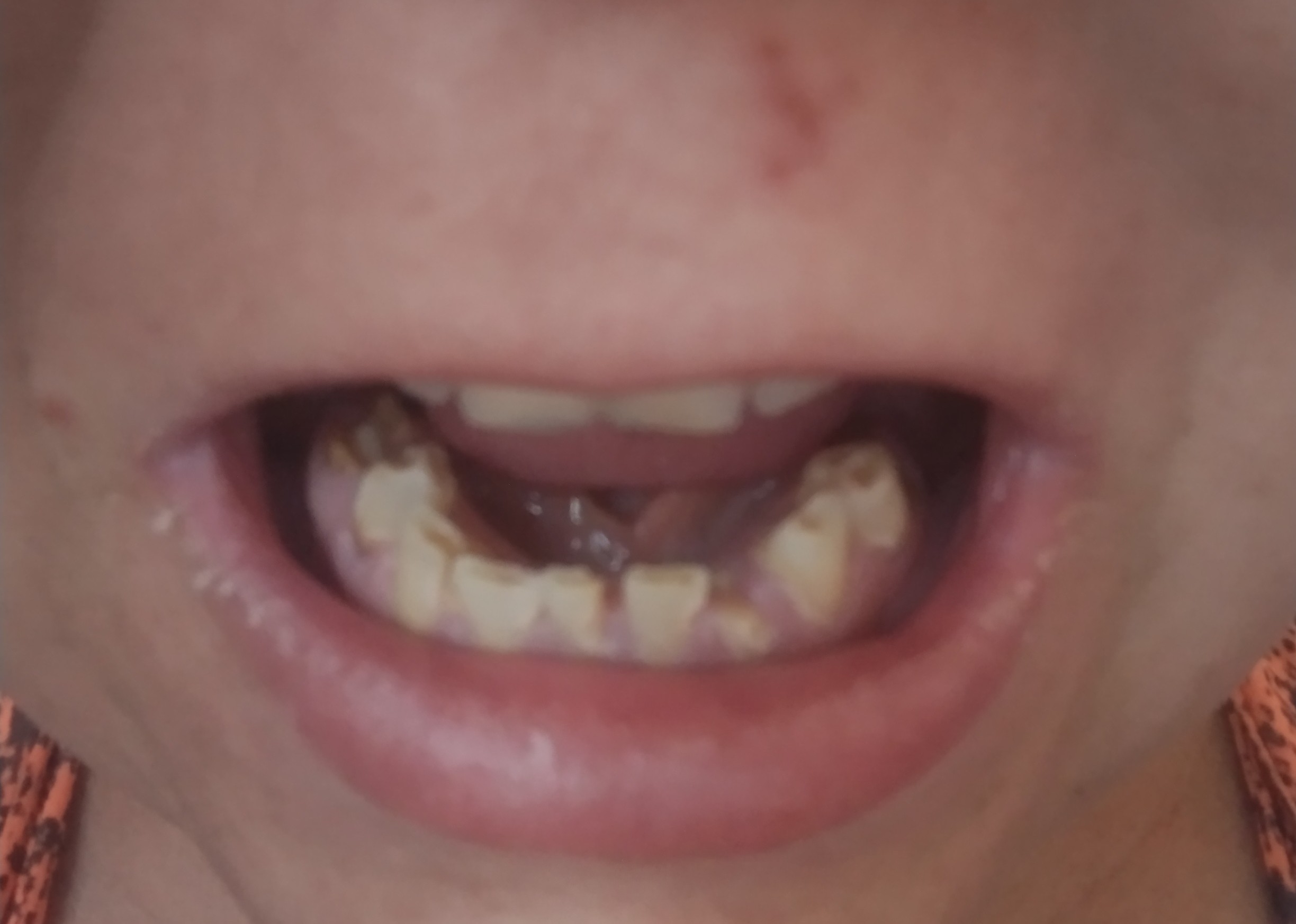 Rifa Em Prol de Vania Todos Pelo Sorriso 