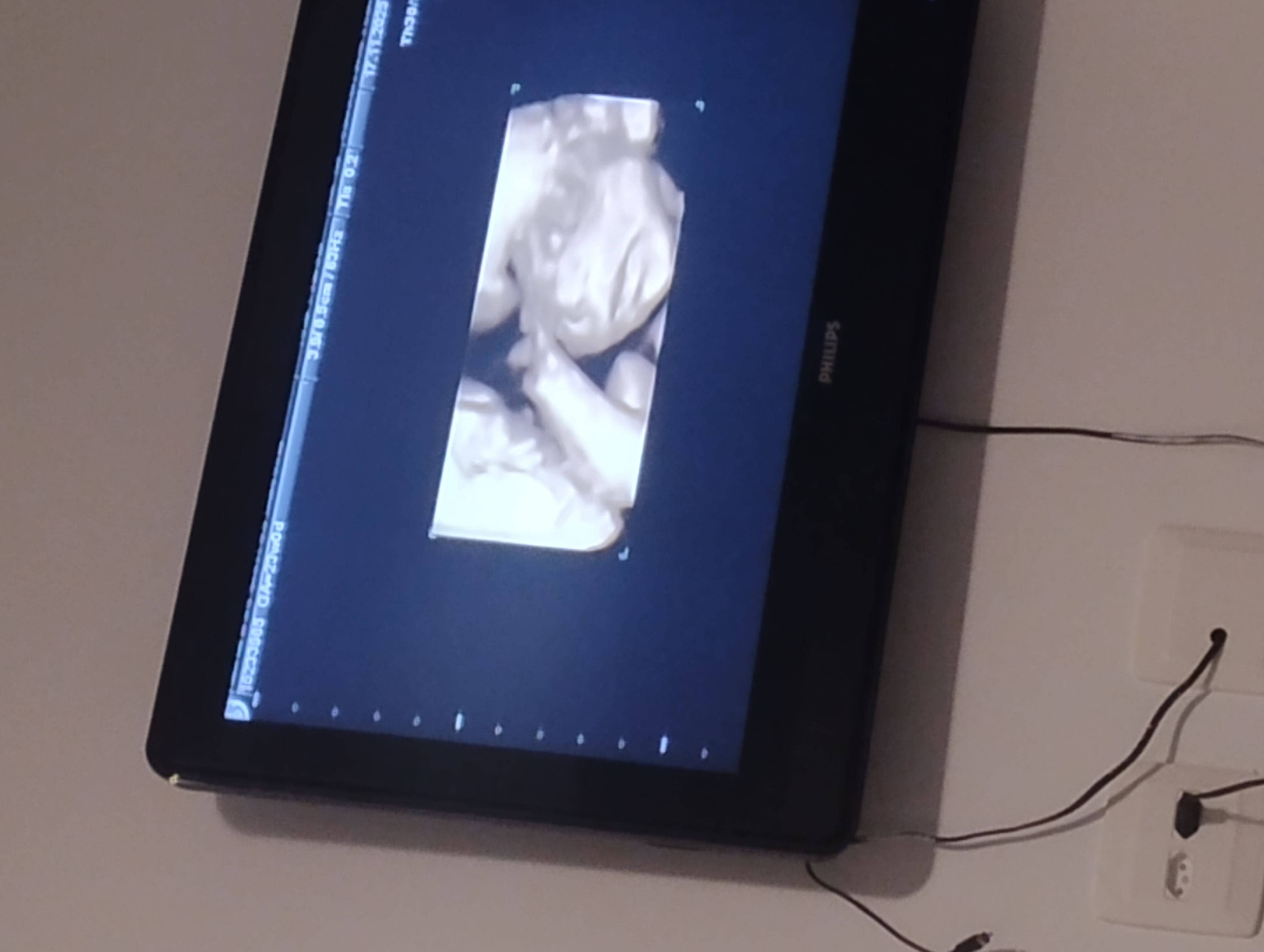 Rifa para ajudar no chá de fraldas da nossa menininha 