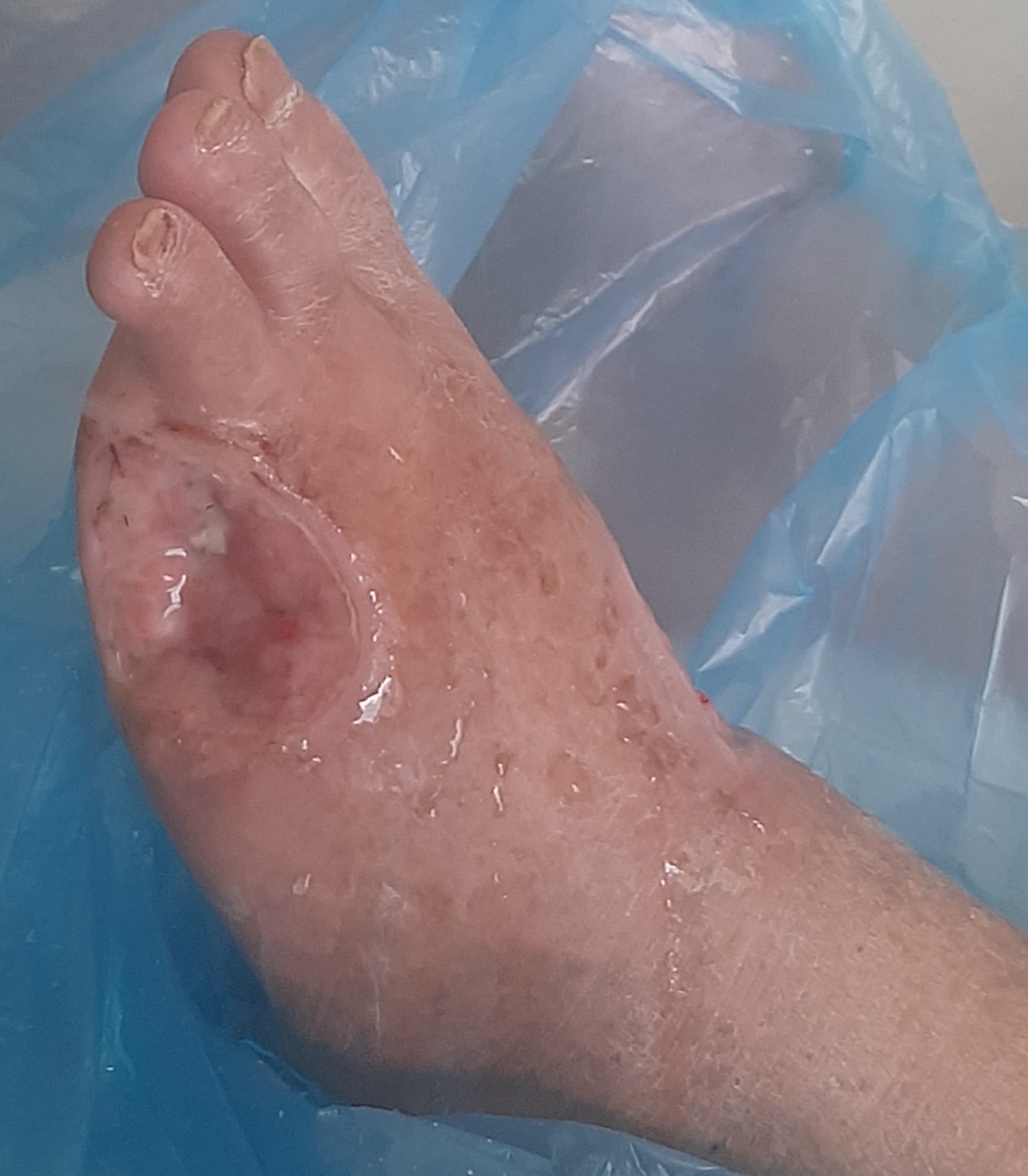 Rifa para ajudar no tratamento do seu Francisco Miranda 