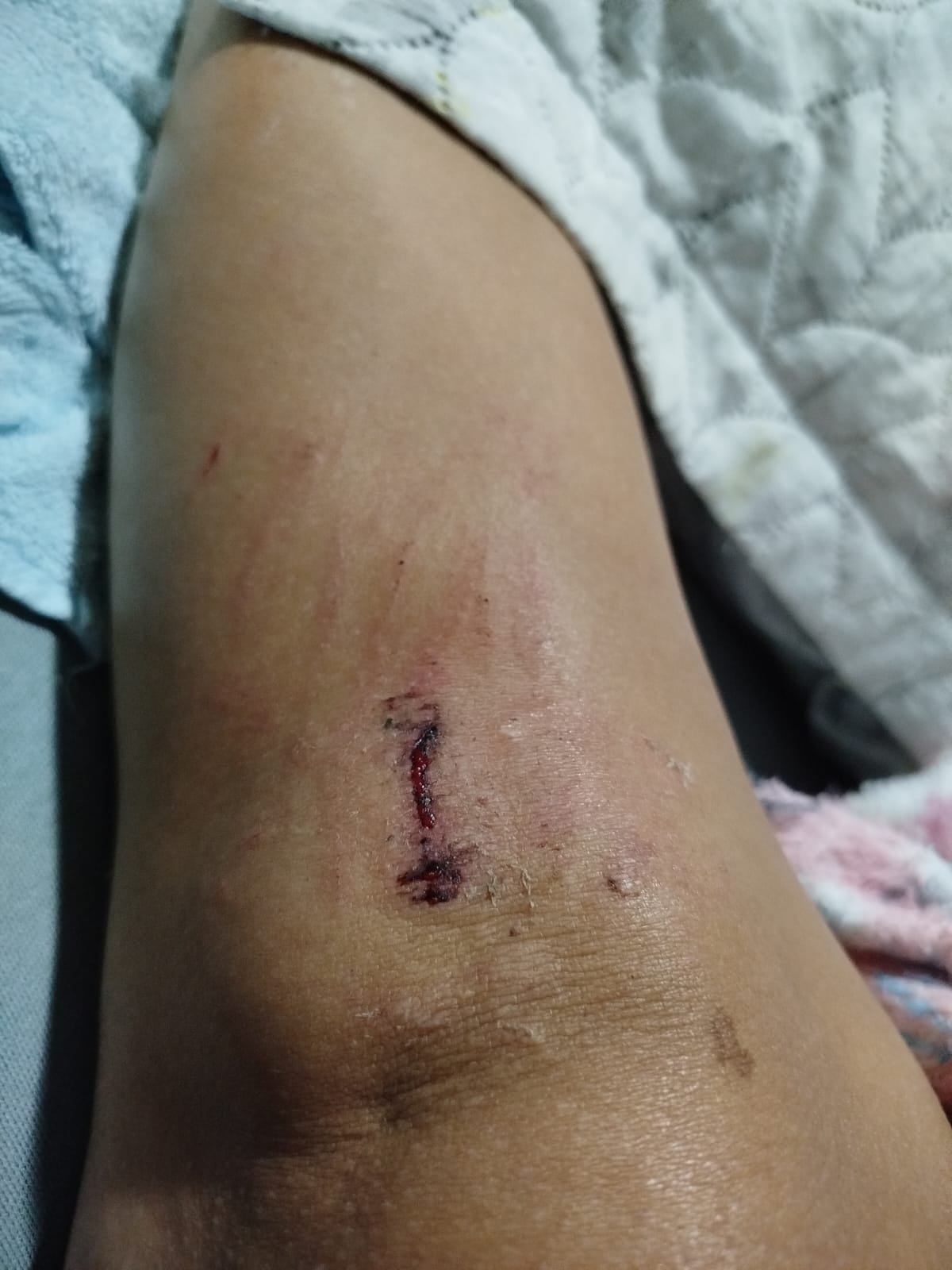 RIFA SOLIDÁRIA AJUDE NA MINHA CIRURGIA