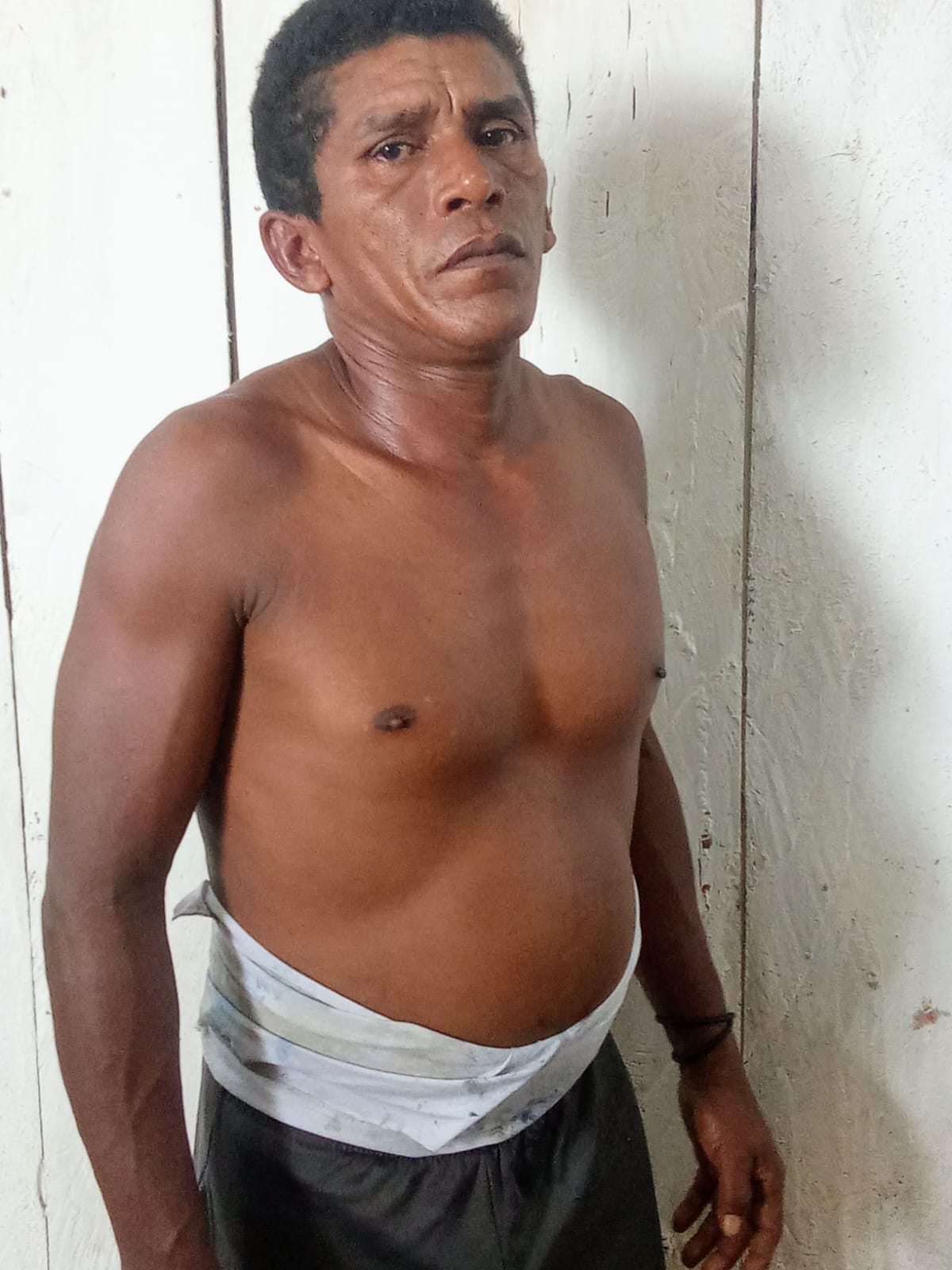 Tratamento do Ribamar 