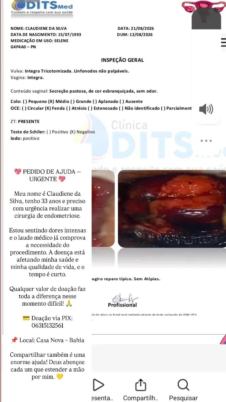 Ajudar cirurgia câncer no útero