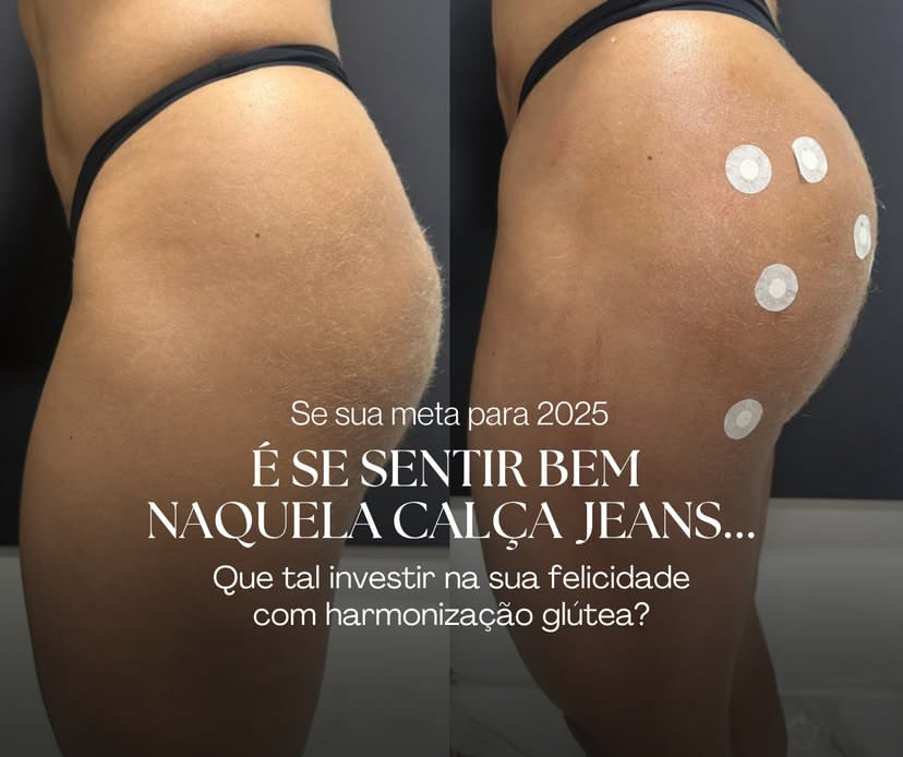 foto 0